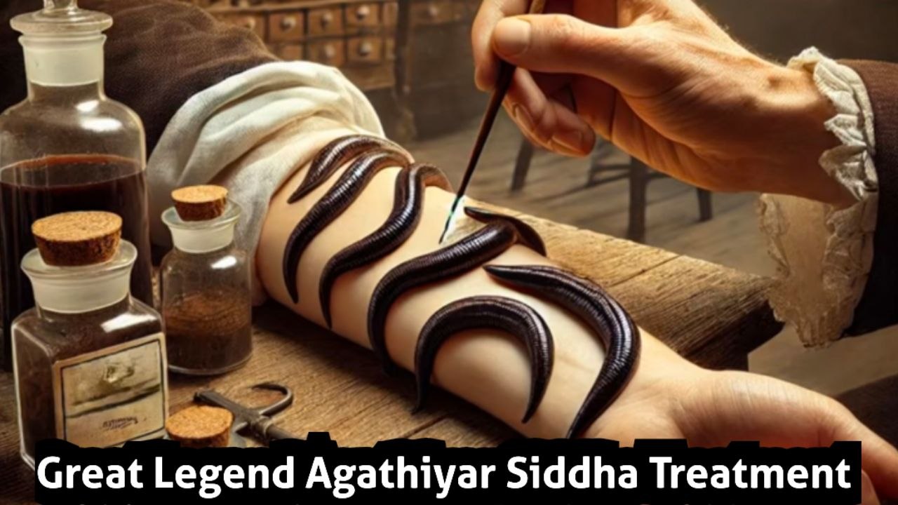 எல்லாவித நோய்களையும் குணப்படுத்தும் அட்டை விடல் அகத்தியரின் சிறப்பு சித்தமருத்துவம்